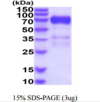 3 μg by SDS-PAGE under reducing condition and visualized by coomassie blue stain.